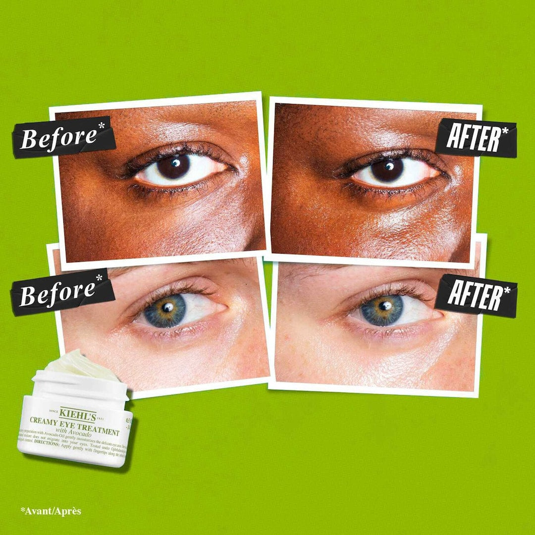 KIEHL'S SINCE 1851 Avocado Eye Cream