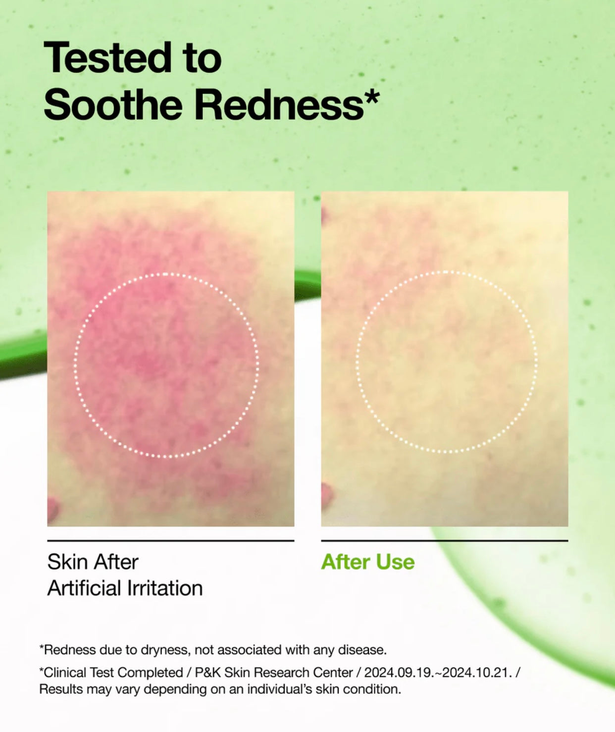 Anua Azelaic Acid 10+ Hyaluron Redness Soothing Serum 30Ml