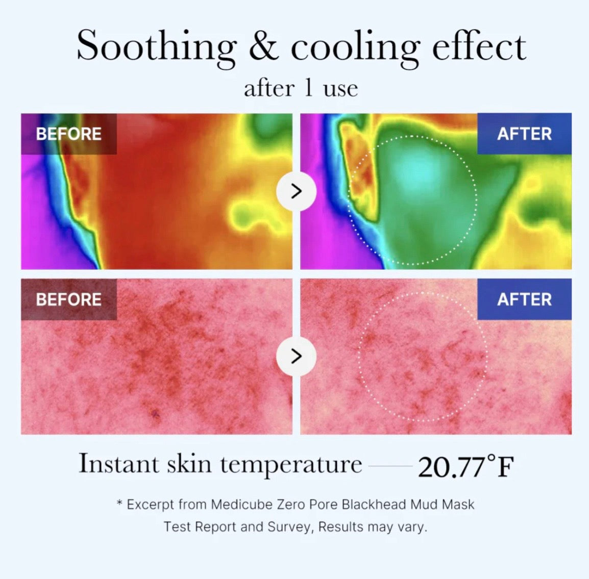Medicube Zero Pore Blackhead Mud Mask