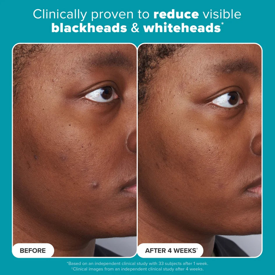 Paula's Choice Skin Perfecting 2% BHA Liquid Exfoliant - Trial Size (30ml)