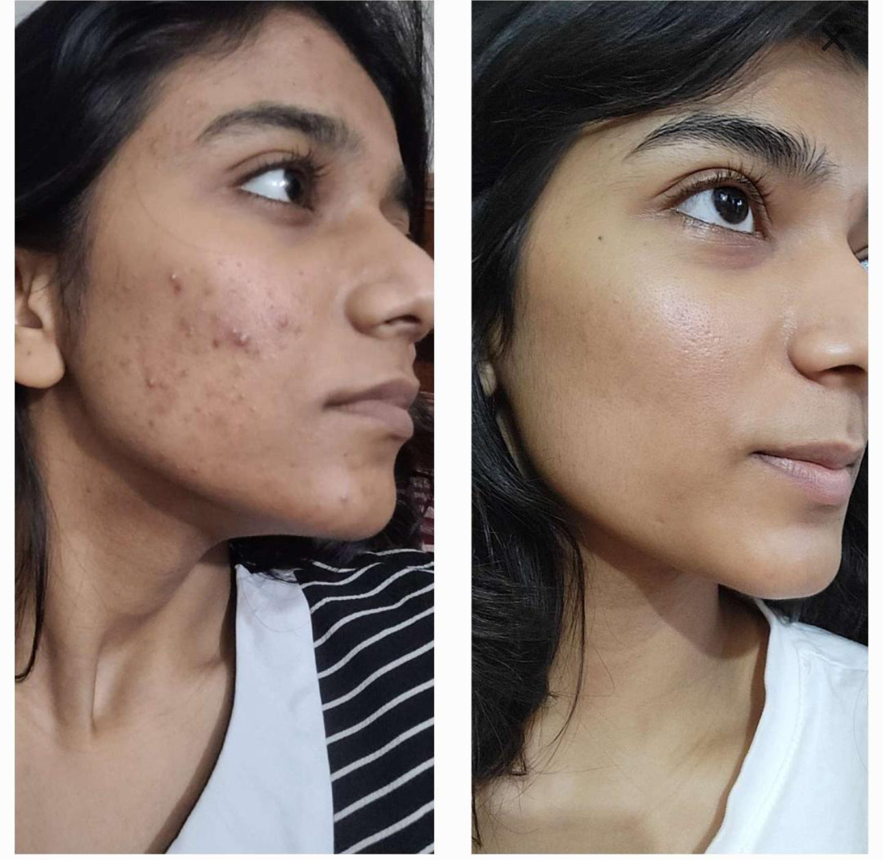 SOME BY MI - Retinol Intense Reactivating Serum 30Ml