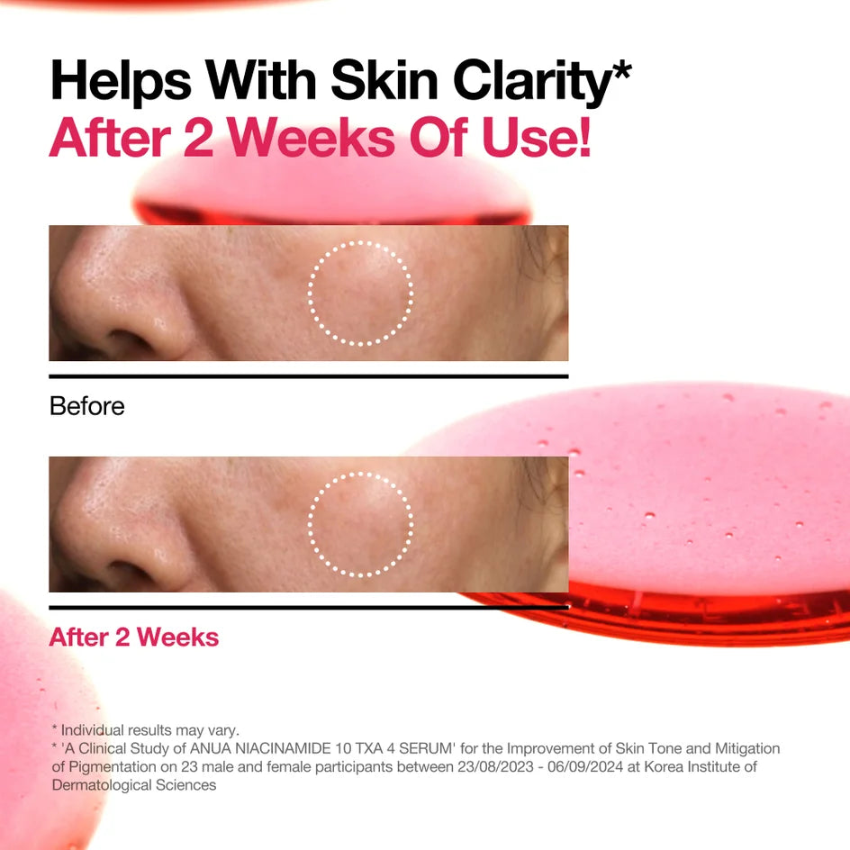 Anua Niacinamide 10% + TXA 4% Serum 30ml