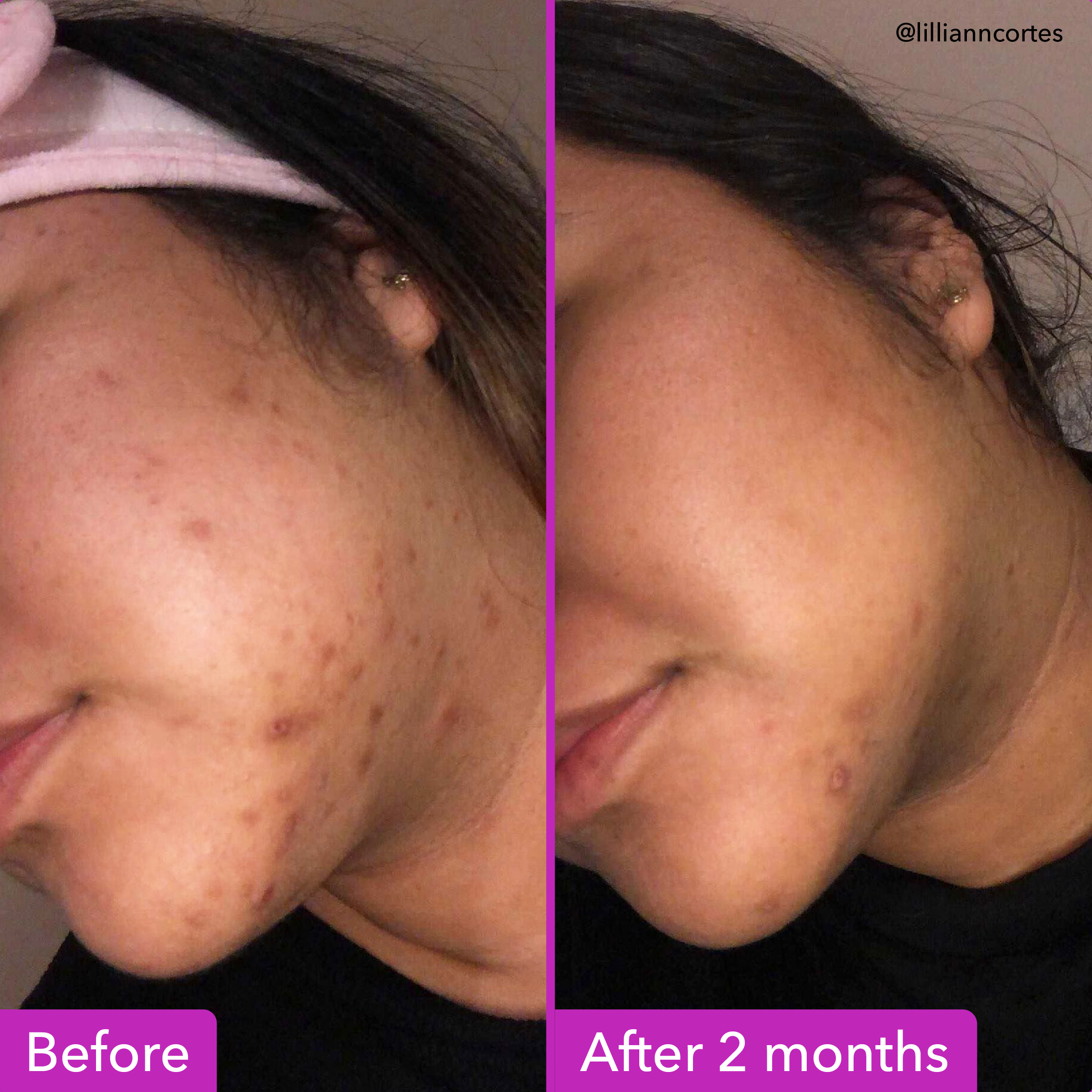 Good Molecules DISCOLORATION CORRECTING SERUM 30Ml