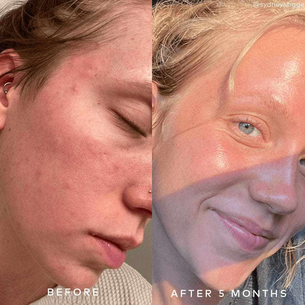 GOOD MOLECULES BHA CLARIFY GEL CREAM