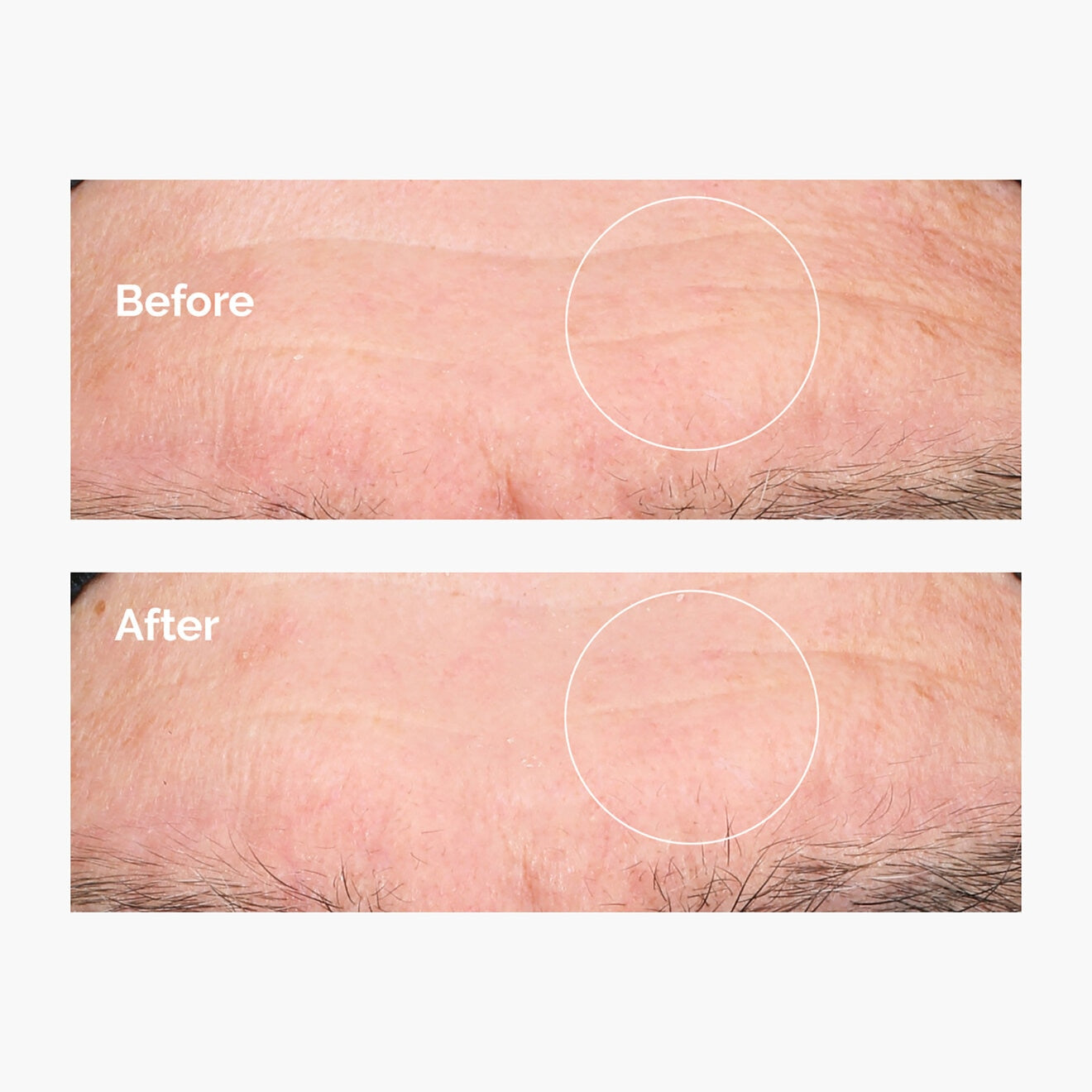 The ordinary Hyaluronic Acid 2% + B5