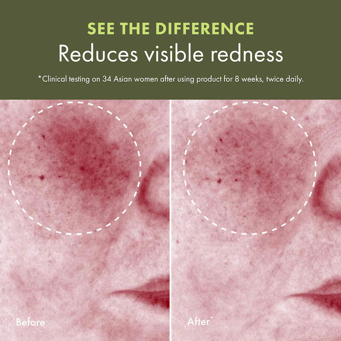 Dr. Andrew Weil for Origins™ Mega-Mushroom Relief & Resilience Soothing Treatment Lotion