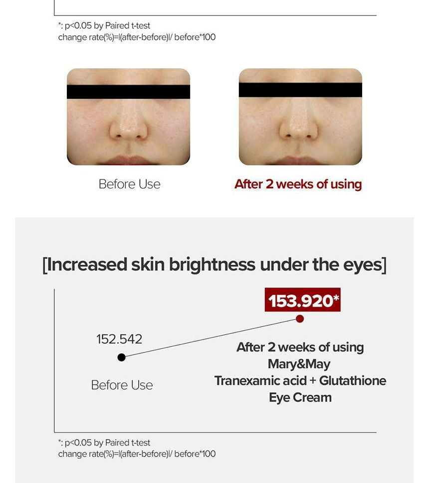 Mary & May Tranexamic Acid+ Glutathione Eye Cream 30ml + FREE 2pc mini Eye Cream