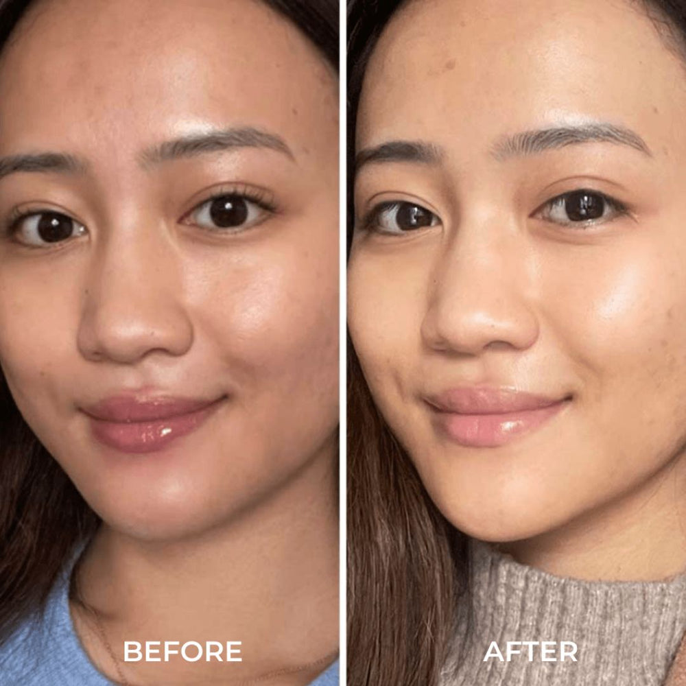 Alpha-H Liquid Gold with 5% Glycolic Acid Travel size, 30ml