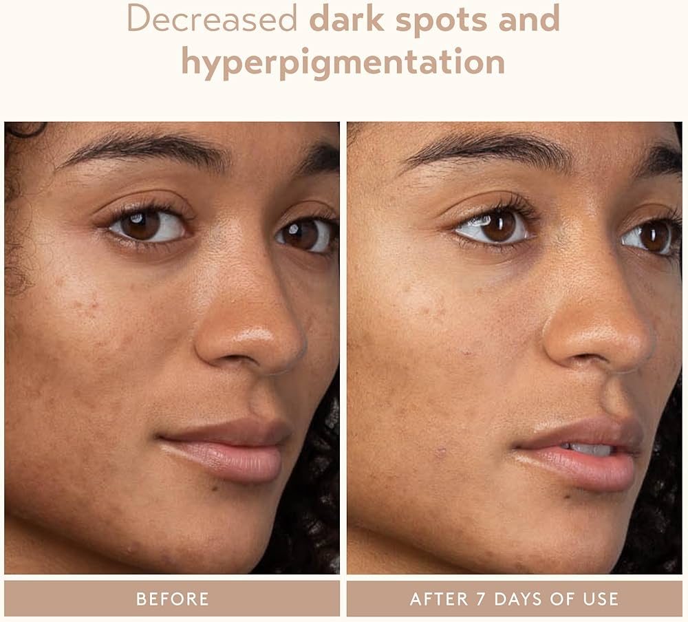 SHANI DARDEN SKIN CARE Lactic Acid Face Serum 7Ml