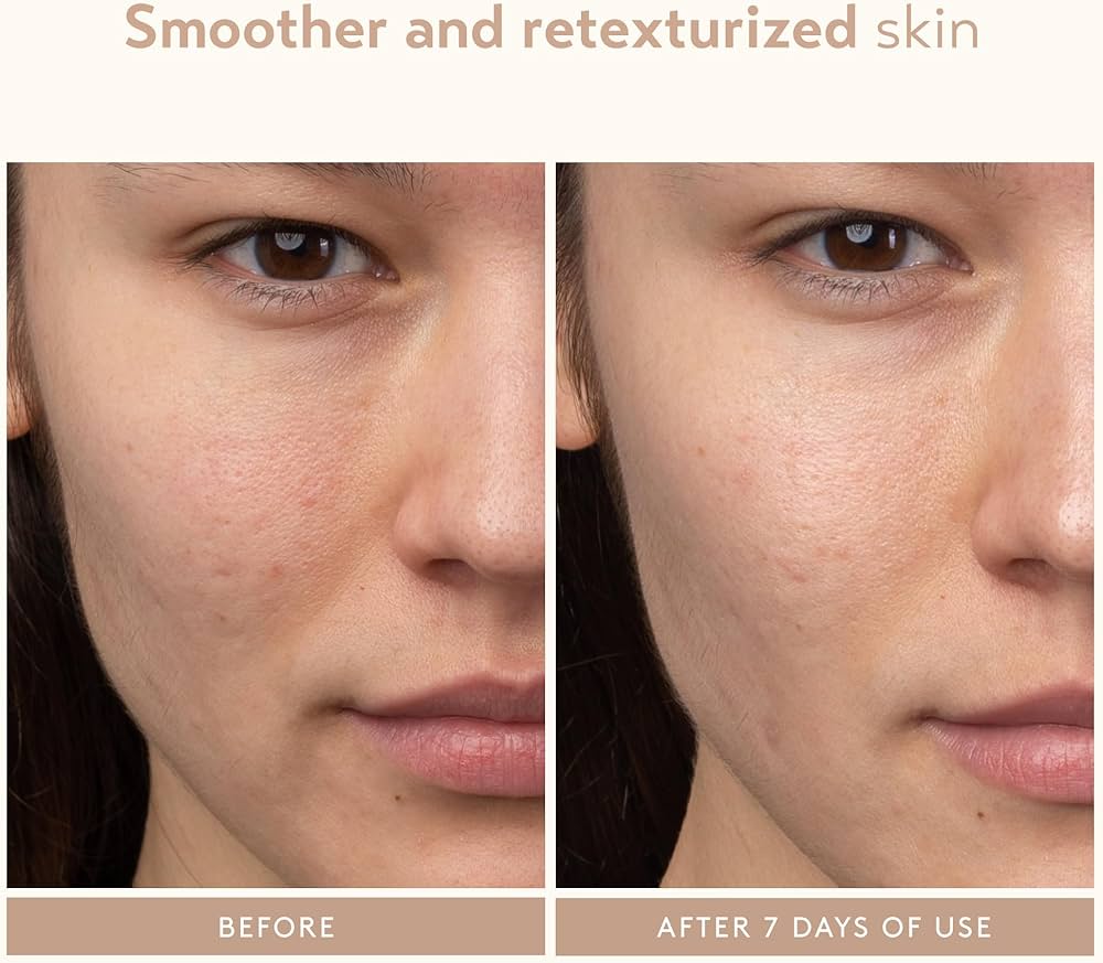 SHANI DARDEN SKIN CARE Lactic Acid Face Serum 7Ml