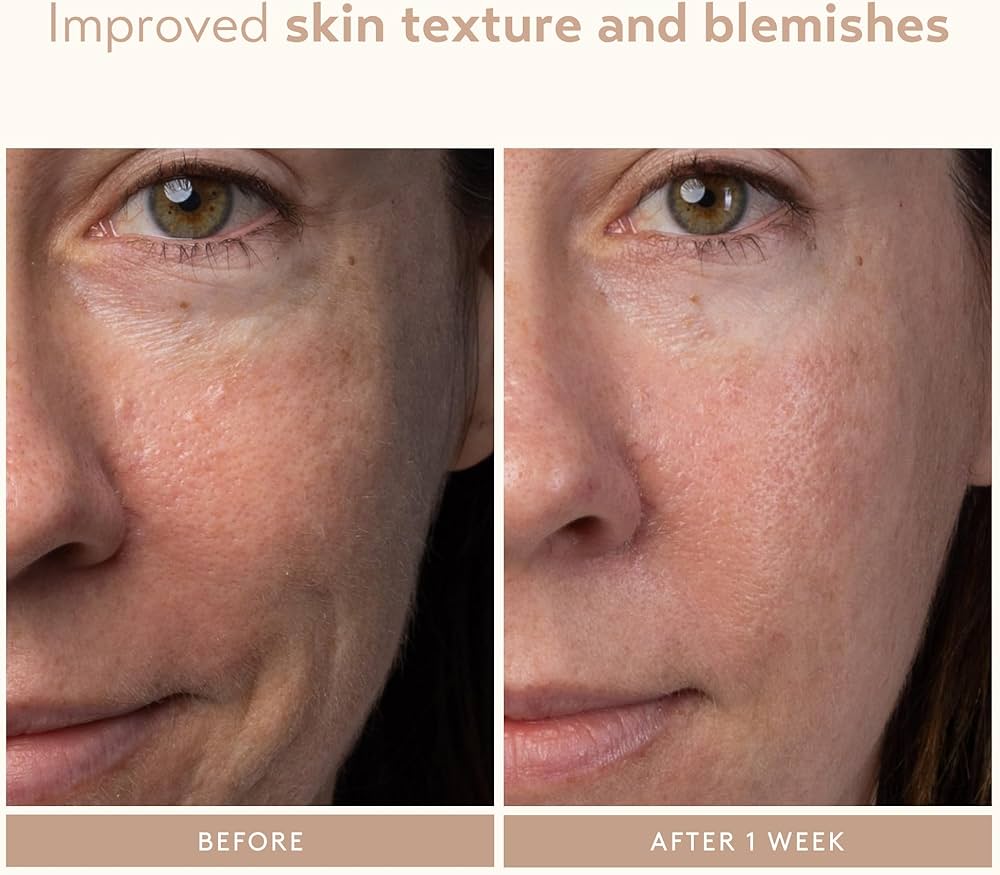 SHANI DARDEN SKIN CARE Lactic Acid Face Serum 7Ml