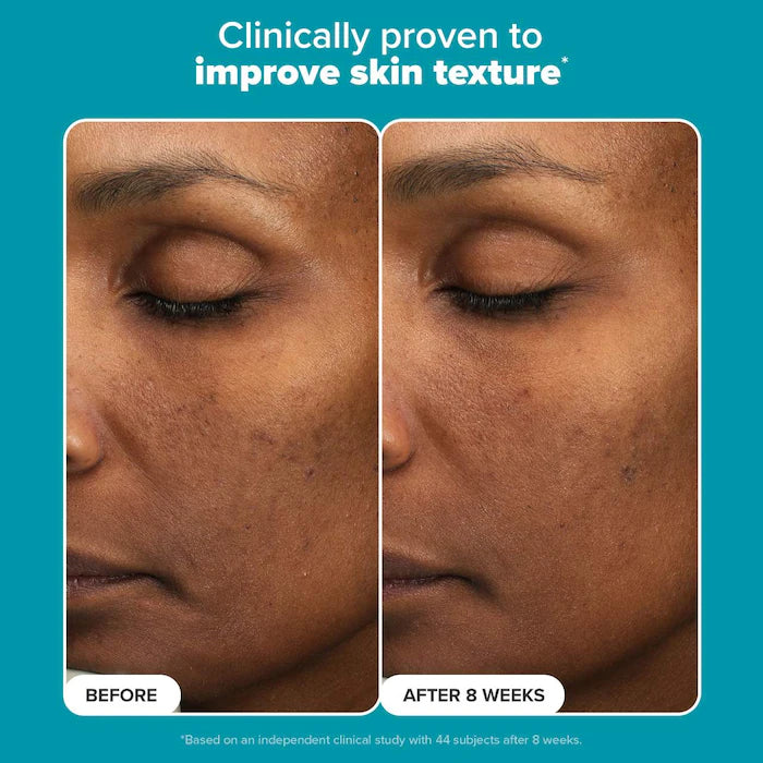 Paula's Choice  Mini Skin Perfecting 6% Mandelic Acid + 2% Lactic Acid Liquid Exfoliant