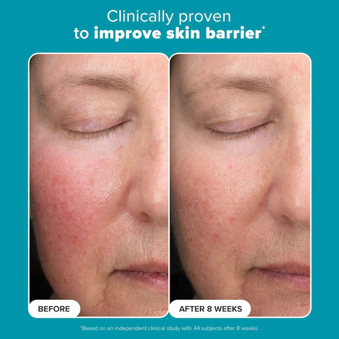 Paula's Choice  Mini Skin Perfecting 6% Mandelic Acid + 2% Lactic Acid Liquid Exfoliant