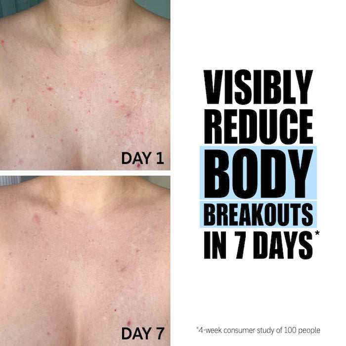 The INKEY List  Glycolic Acid Exfoliating Body Stick