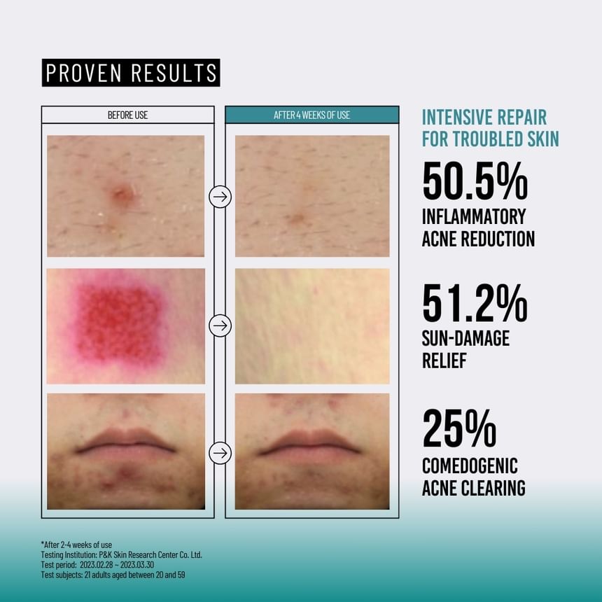 Snail Mucin 95 + Peptide Facial Essence, 4.73 fl oz (140 ml)