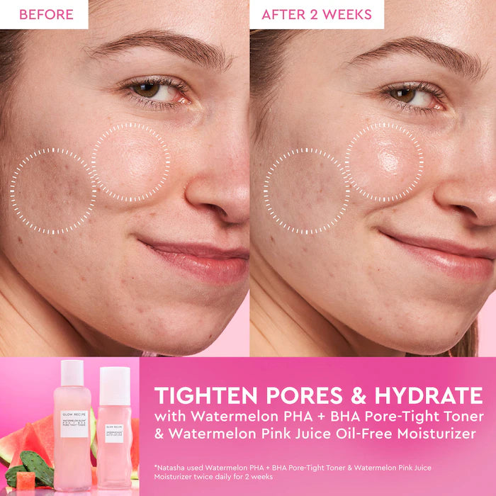 Glow Recipe  Watermelon Glow PHA + BHA Pore-Tight Toner