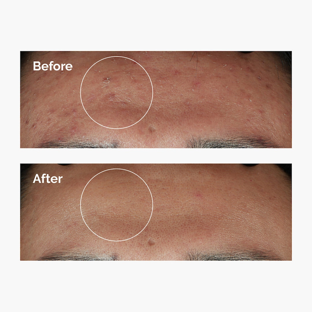 The Ordinary Niacinamide 10% + Zinc 1% Serum 30ml