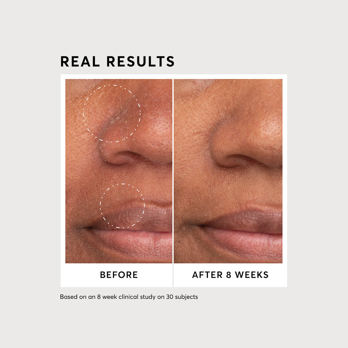 Niacinamide Serum 12% Plus Zinc 2%