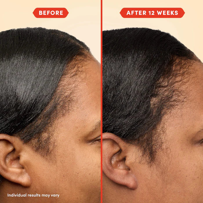 Fable & Mane  HoliRoots™ Pre-Wash Scalp & Hair Treatment Oil